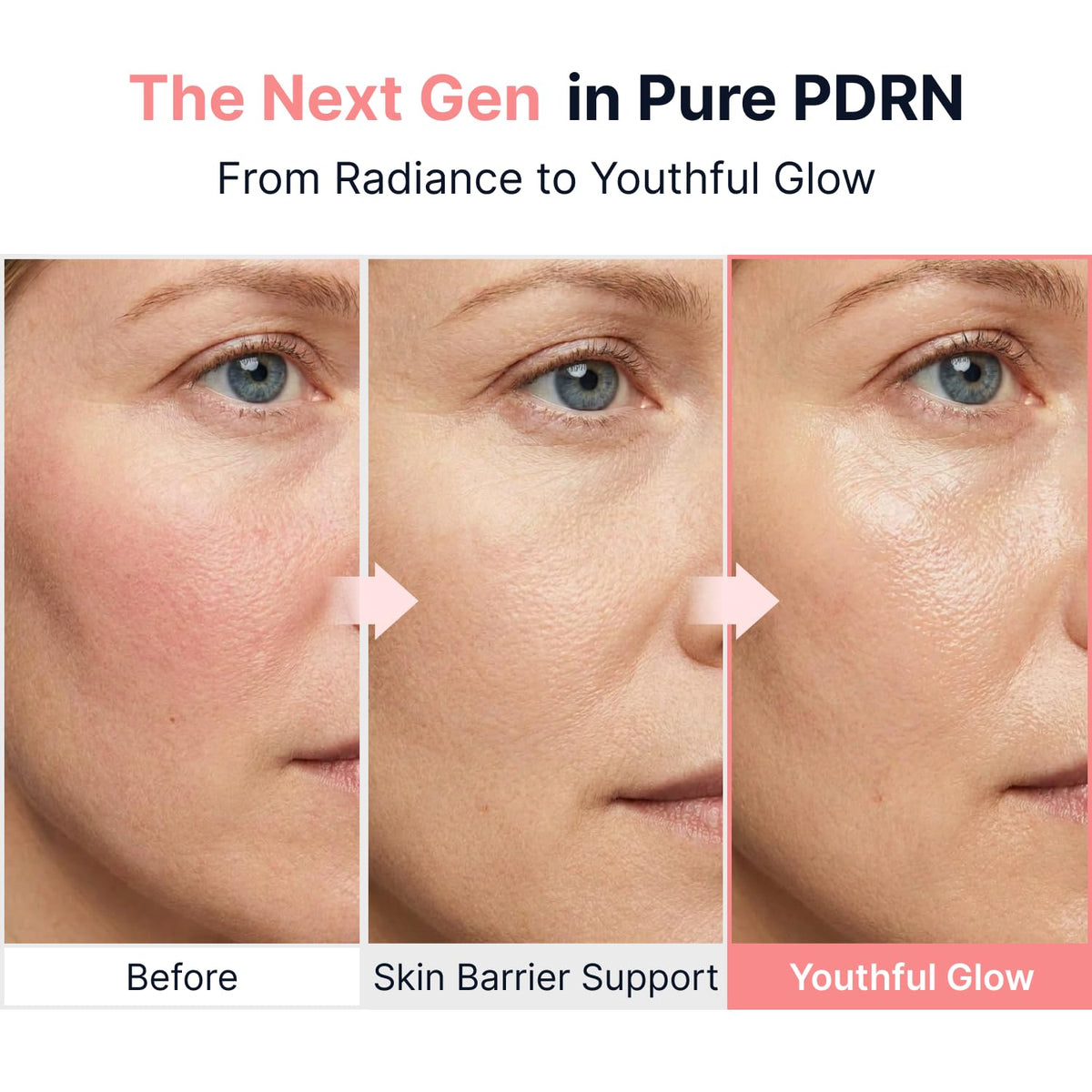 Pink PDRN Glow Boosting Ampoule – Αμπούλα Λάμψης & Ελαστικότητας με PDRN