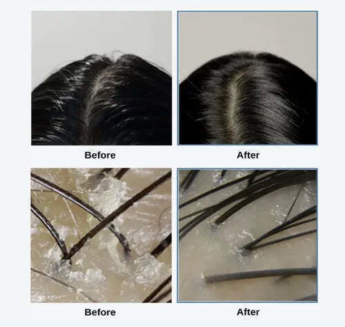 Growus Scalp Scrub 250gr