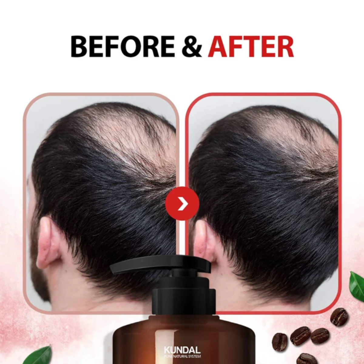 KUNDAL Caffeine Shampoo White Musk – Σαμπουάν με Καφεΐνη για Τόνωση, Όγκο & Ε 500ml