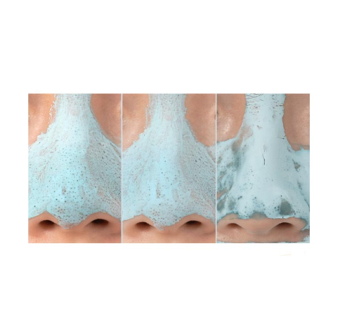 Medicube - Zero Pore Blackhead Mud Mask 100ml