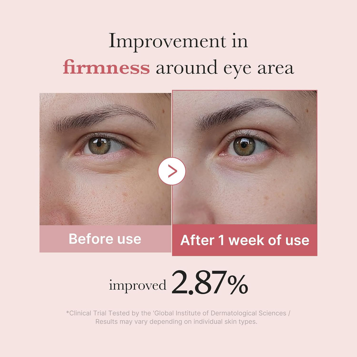 PDRN Pink Peptide Eye Cream - Κρέμα ματιών για ρυτίδες και μαύρους κύκλους 30ml