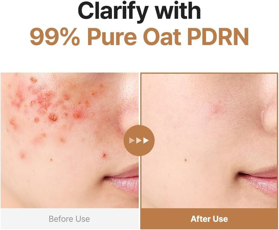 Purito Oat Pdrn Τόνωσης Προσώπου 200ml