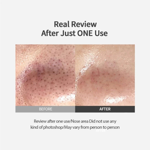 Sungboon Editor Blackhead Melting Clear Pad 30pads