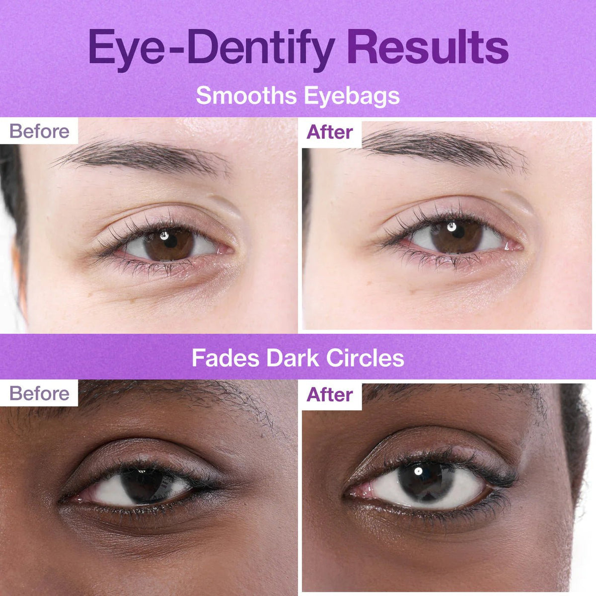 No.9 NAD Collagen Under Eye Patches - Eye Patches με Κολλαγόνο & 50 Πεπτίδια 5τμχ